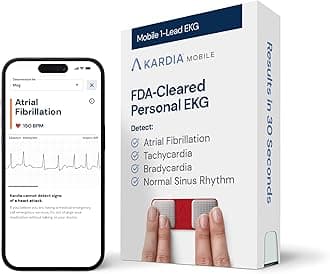 KardiaMobile 1-Lead EKG Monitor, Medical-Grade FDA-Cleared Personal Heart Monitor, Detects Normal, AFib & Arrhythmias, 30 Second Results, Works with Smartphones, Pocket Size, No Subscription Required