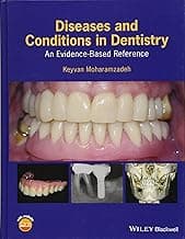 Diseases and Conditions in Dentistry: An Evidence-Based Reference