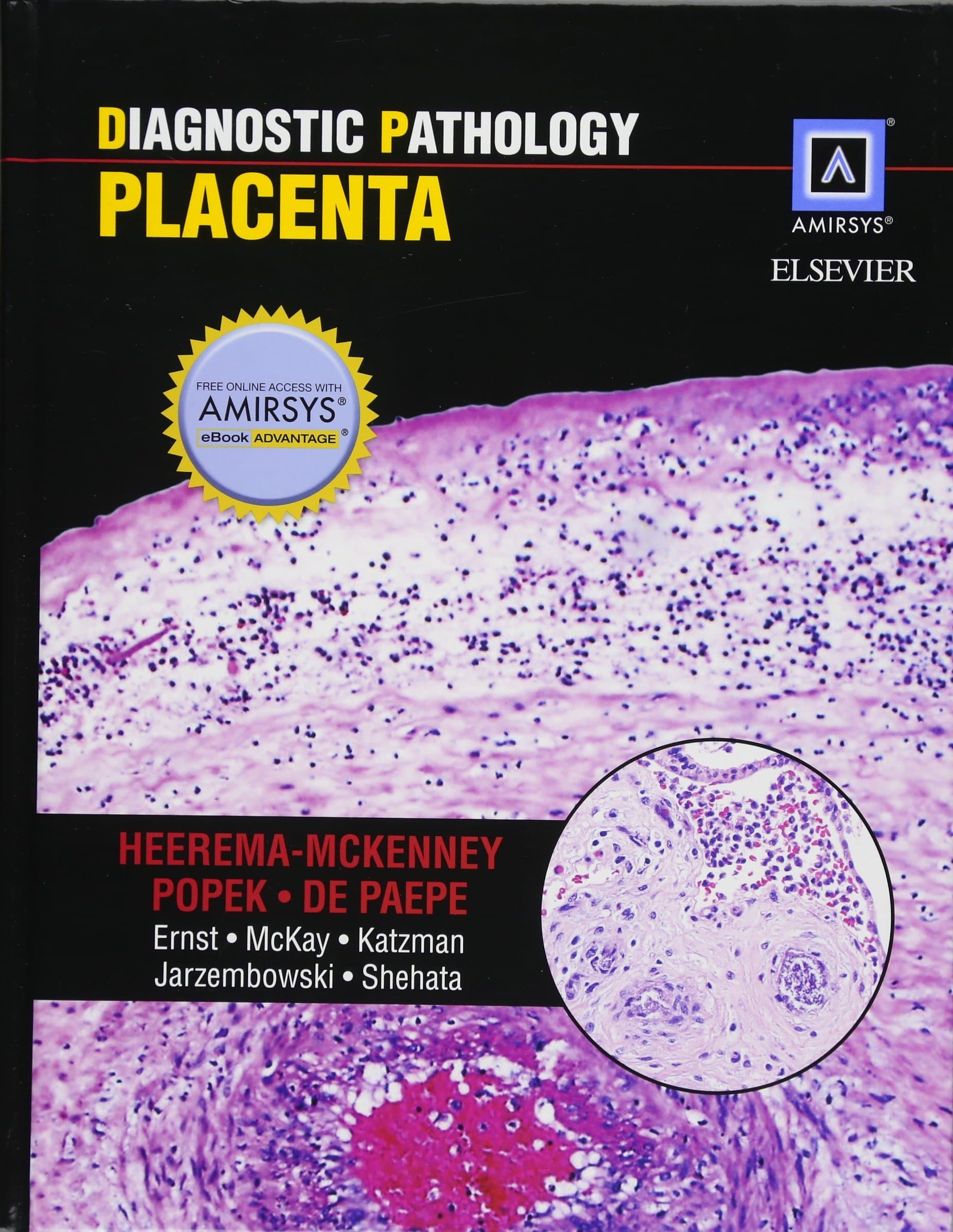 Diagnostic Pathology: Placenta 1st Edition